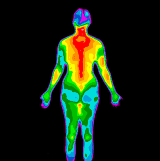 Thermography